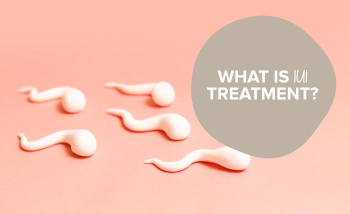 What is IUI treatment?