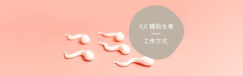 什么是 IUI 辅助生育? 什么是 IUI 辅助生育?