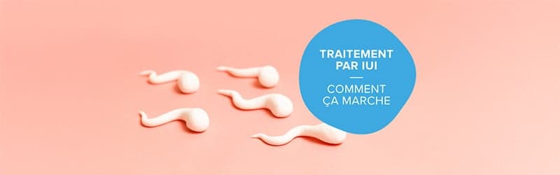 Qu’est-ce que le traitement par IUI ? Qu’est-ce que le traitement par IUI ?