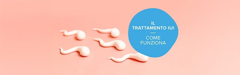 Che cos'è il trattamento IUI? Che cos'è il trattamento IUI?