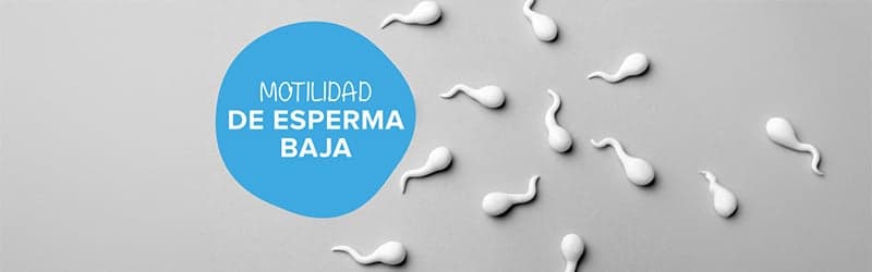 Qué es la motilidad de esperma baja y cómo intentar prevenirla Qué es la motilidad de esperma baja y cómo intentar prevenirla