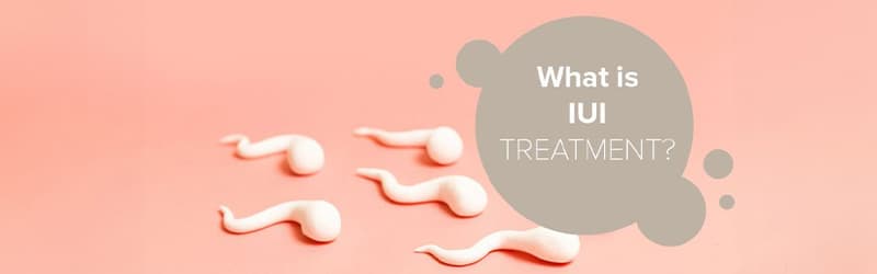 What is IUI treatment? What is IUI treatment?