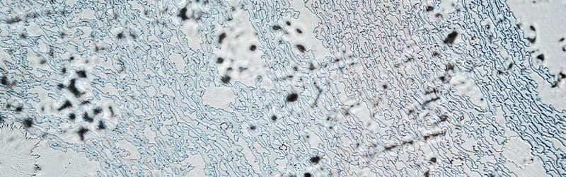 Close up of sperm cells Close up of sperm cells