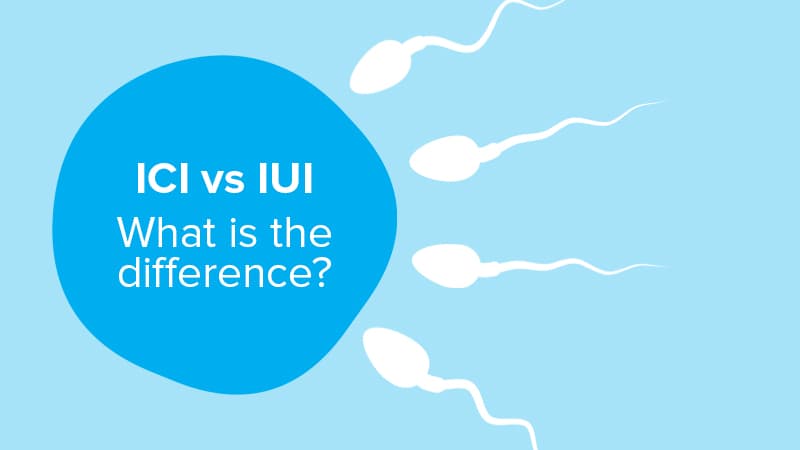 Illustration of sperm cells