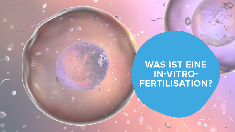 Was ist IVF?