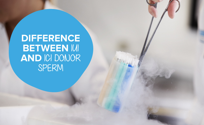 The difference between IUI and ICI sperm straws