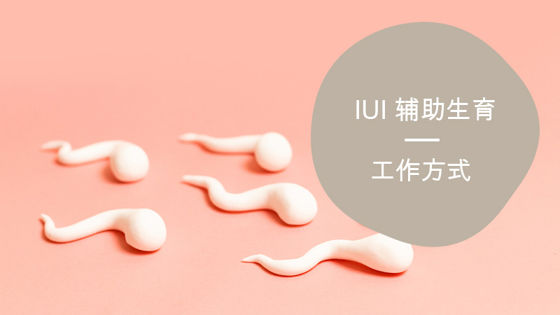什么是 IUI 辅助生育？