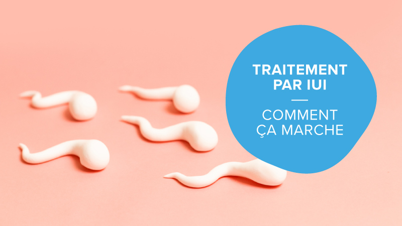 Qu’est-ce que le traitement par IUI ?