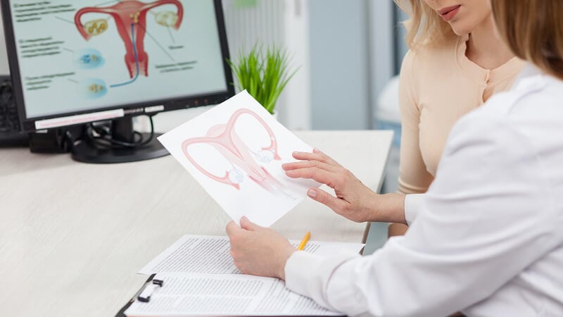 IUI