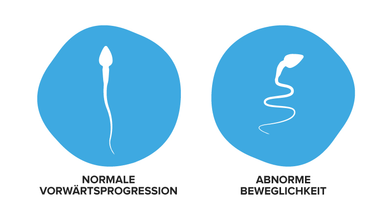 Bei einer niedrigen Spermienmotilität ist die Beweglichkeit der Samenzellen reduziert