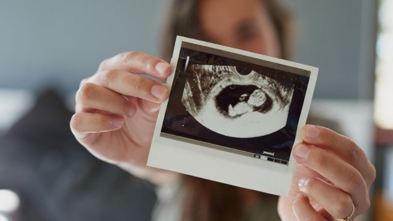 An ultrasound image of an egg donor-conceived child
