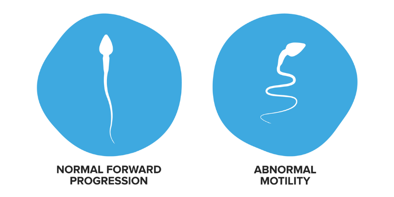 Sperm Motility Pregnancy Telegraph