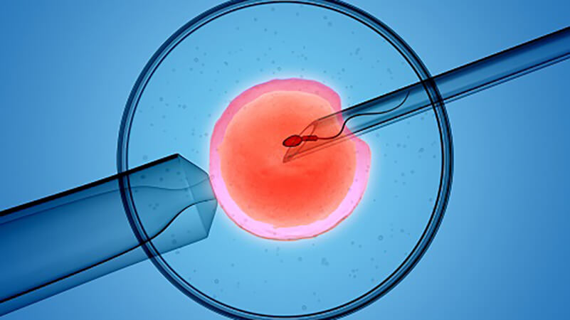 IVF is one of the most well known infertility treatment options