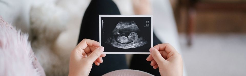 Succesfull pregnancy ultrasound