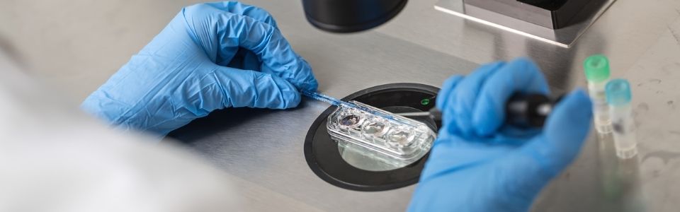 Donor egg being fertilized by a doctor