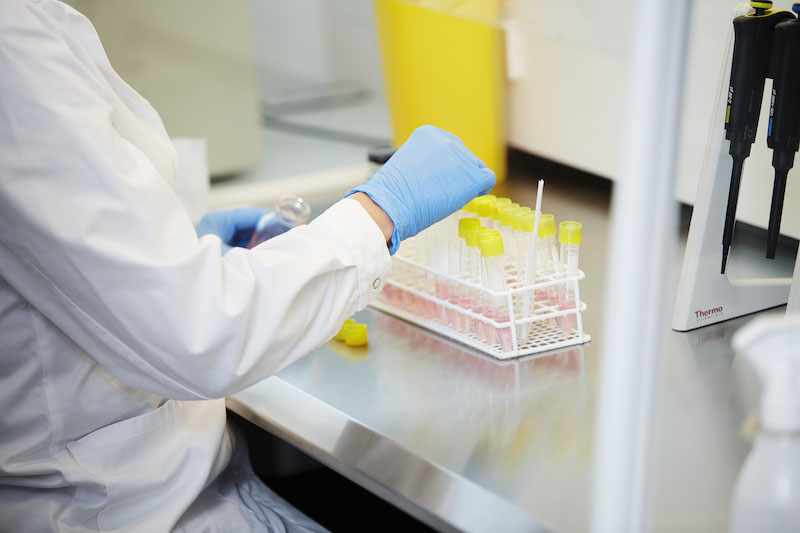 Cryos' scientists have studied whether COVID-19 transmits through sperm