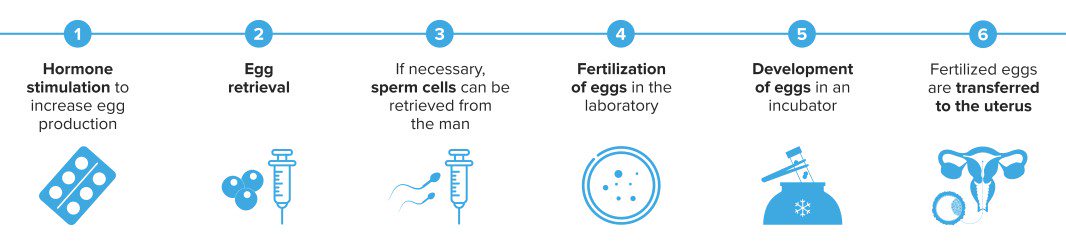 The proces of ICSI treatment