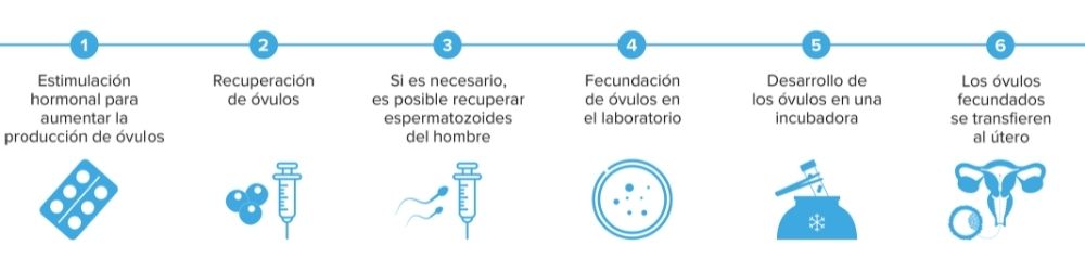 Ilustración del proceso al que se somete al recibir un tratamiento ICSI 