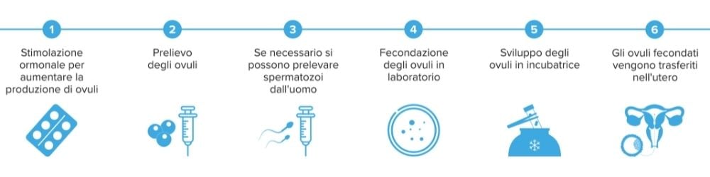 Un'illustrazione della procedura prevista per il trattamento ICSI 
