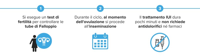 La procedura del trattamento di fertilità IUI