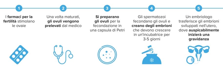Un'illustrazione delle procedure di trattamento IVF