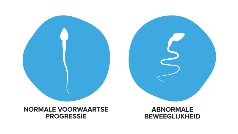 Een reden voor lage spermamotiliteit kan de beweeglijkheid van zaadcellen zijn
