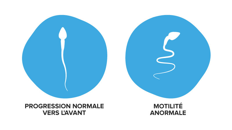 L’une des causes d’une faible motilité du sperme peut être le déplacement des spermatozoïdes