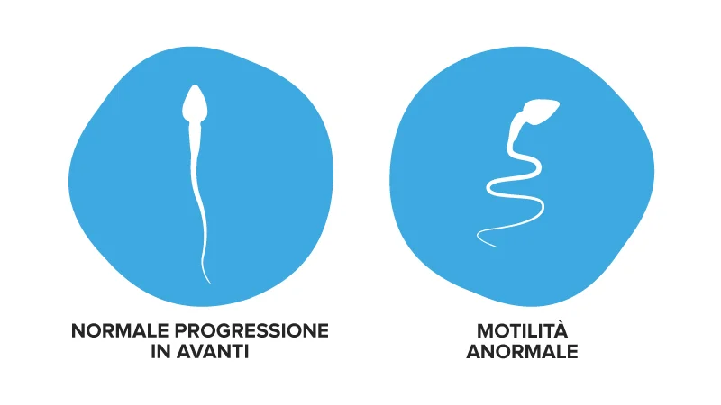 Una delle cause della bassa motilità del seme può essere il movimento insufficiente degli spermatozoi