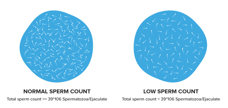 Illustration of the difference between normal and low sperm count