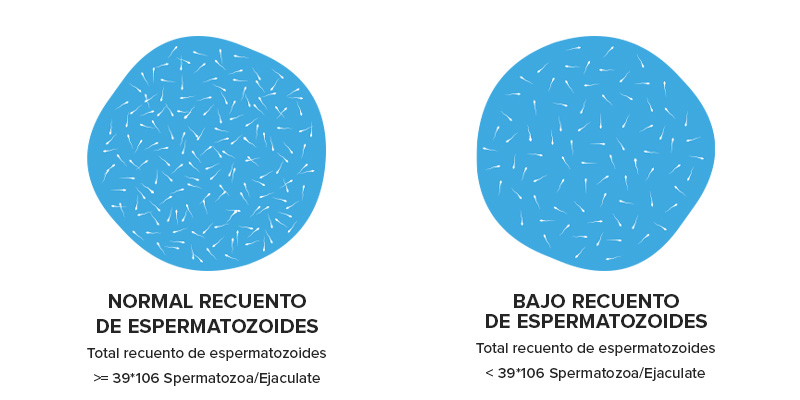 Ilustración de la diferencia entre un recuento de espermatozoides normal y bajo