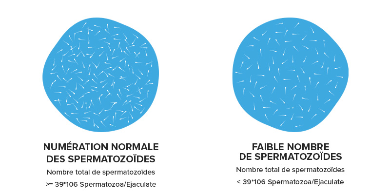 Illustration de la différence entre un nombre normal et un nombre réduit de spermatozoïdes 