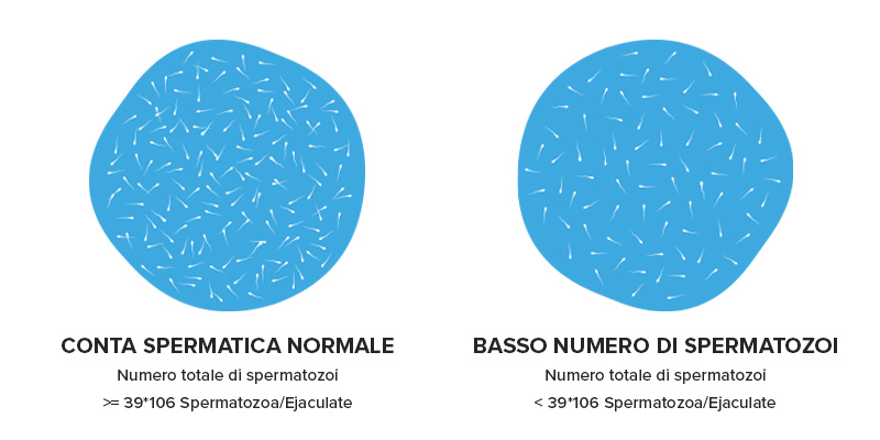 Confronto tra quantità normale di spermatozoi e scarsa concentrazione degli spermatozoi