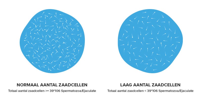 Illustratie van het verschil tussen een normaal en laag aantal zaadcellen