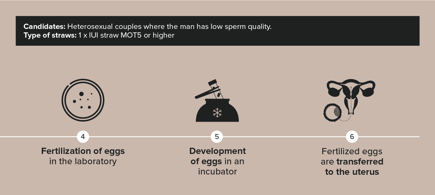 Infographic about IVF treatment Infographic about IVF treatment