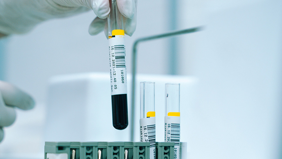 DNA samples in test tubes.