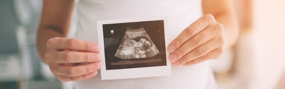 A pregnant single mother by choice